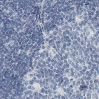 Staining of human lymph node.