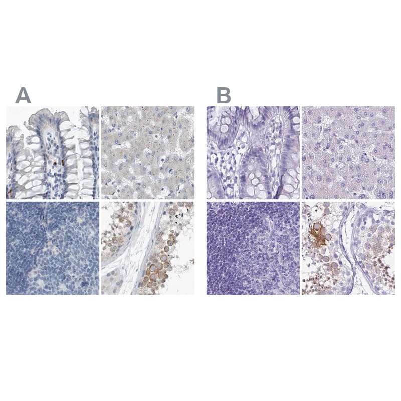 Staining of human colon, liver, lymph node and testis HPA027997 (A) shows similar protein distribution across tissues to independent antibody HPA053070 (B).
