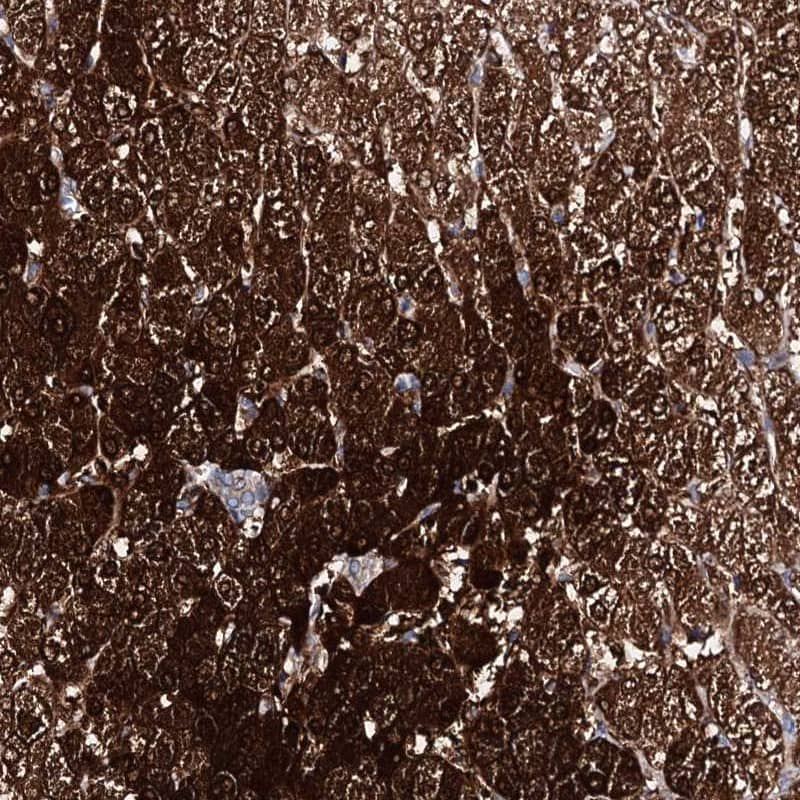 Staining of human liver shows strong cytoplasmic positivity in hepatocytes.
