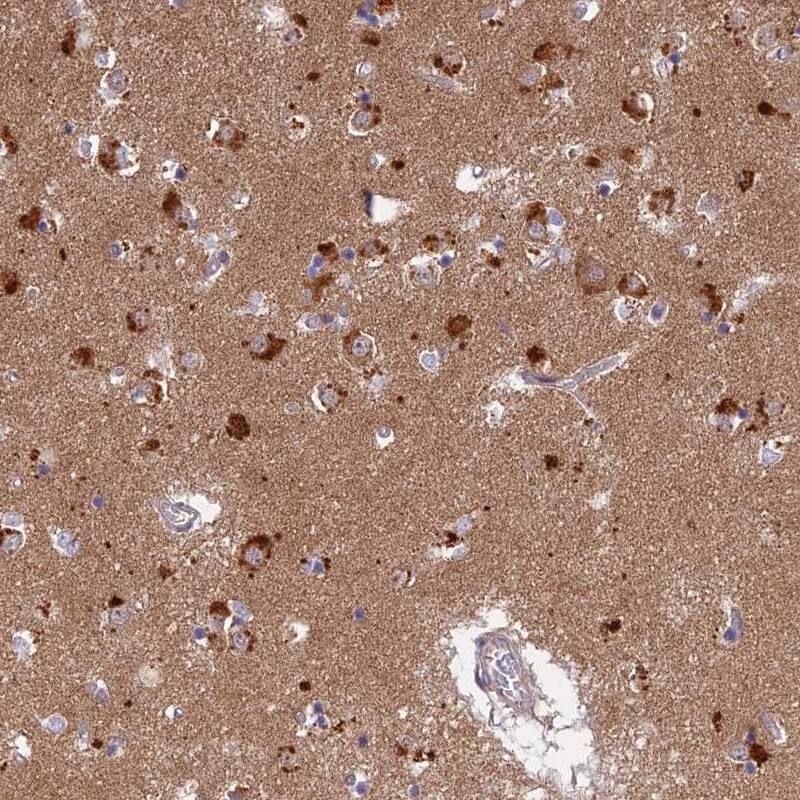 Staining of human caudate shows strong cytoplasmic positivity in neuronal cells.