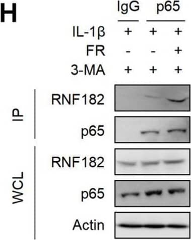 FR promotes the K48-linked ubiquitination of p65 by recruiting the E3 ubiquitin enzyme RNF182. Tenocytes were silenced with RNF182 siRNA (A), ING4 siRNA (B), or PPAR gamma  siRNA (C) for 24 h and then treated with IL-1 beta  (10 ng/mL) and FR (40 μM) for 24 h. Finally, the protein expression of p65 was detected by WB. (D) HEK293T cells were treated with RNF182 siRNA for 24 h, then transfected with HA-K48-Ub and Flag-p65 plasmids for 12 h, and next stimulated with 3-MA (5 mM) for 6 h, and finally treated with FR (40 μM) for 8 h. Cell lysates were collected for IP and WB detection. (E) Tenocytes were transfected with RNF182 siRNA for 24 h, then treated with 3-MA (5 mM) for 6 h, and finally treated with IL-1 beta  (10 ng/mL) and FR (40 μM) for 24 h. Cell proteins were collected for IP. The expressions of p65 and K48-Ub in IP and WCL samples were detected by WB. (F) Flag-p65 and GFP-RNF182 plasmids were transfected into HEK293T cells for 24 h and then treated with FR (40 μM) for 8 h. Finally, WB was used to detect the protein of the Flag tag and GFP tag. (G) HEK293T cells were transfected with Flag-p65 and GFP-RNF182 plasmids for 24 h, then 3-MA (5 mM) was added for 6 h and then treated with FR (40 μM) for another 8 h. Finally, cell proteins were collected for IP, and proteins with Flag and GFP labels were detected by WB. (H) Tenocytes were pretreated with 3-MA (5 mM) for 6 h, followed by the addition of IL-1 beta  (10 ng/mL) and FR (40 μM) for 24 h. Cell proteins were collected for IP. WB detected the protein expressions of p65 and RNF182 in IP and WCL samples. Data are expressed as the means +/- SD from three independent experiments. Image collected and cropped by CiteAb from the following open publication (//pubmed.ncbi.nlm.nih.gov/35458235), licensed under a CC-BY license. Not internally tested by Novus Biologicals.