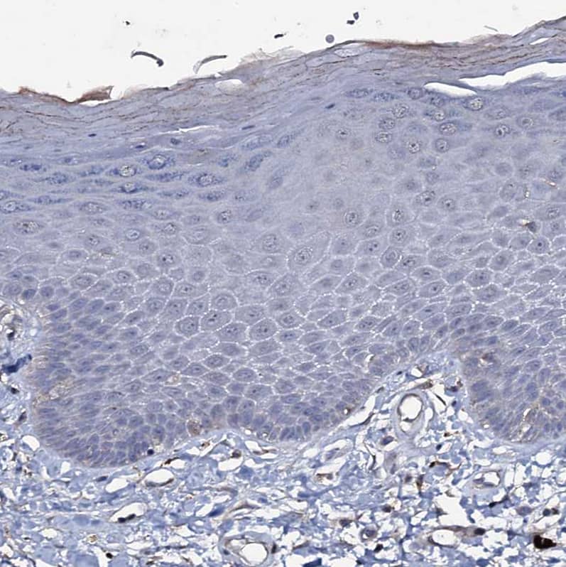 Staining of human skin shows no positivity in squamous epithelial cells as expected.