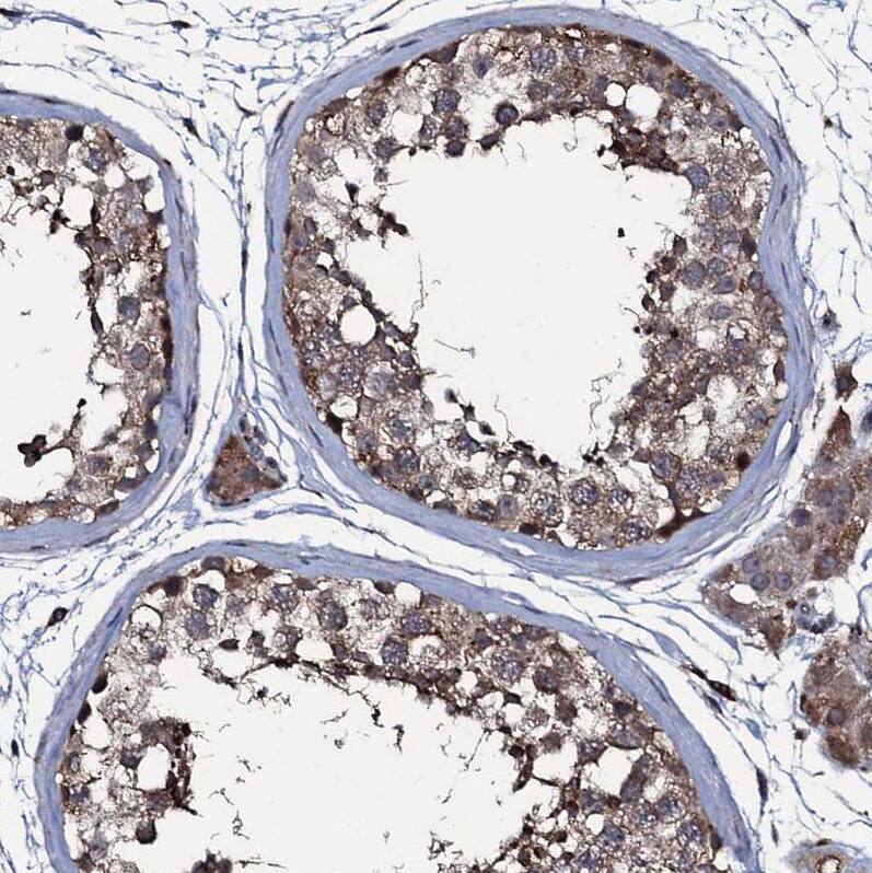 Staining of human testis shows moderate to strong cytoplasmic positivity in cells in seminiferous ducts.