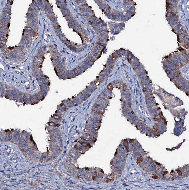 Staining of human fallopian tube shows strong positivity in cilia in glandular cells.