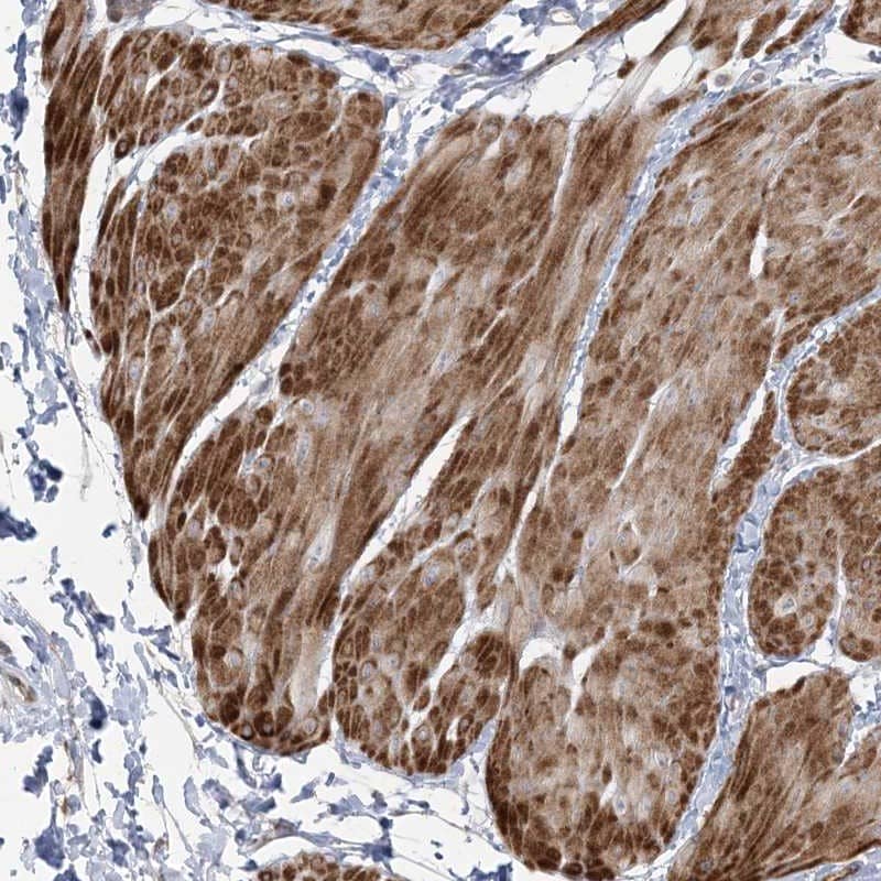 Staining of human smooth muscle shows strong cytoplasmic positivity in smooth muscle cells.
