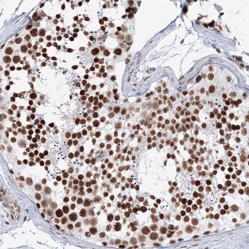 Immunohistochemistry-Paraffin ZNF638 Antibody - BSA Free