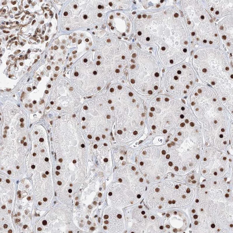 Immunohistochemistry-Paraffin ZNF638 Antibody - BSA Free