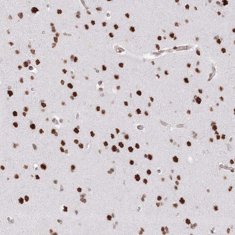 Immunohistochemistry-Paraffin ZNF638 Antibody - BSA Free