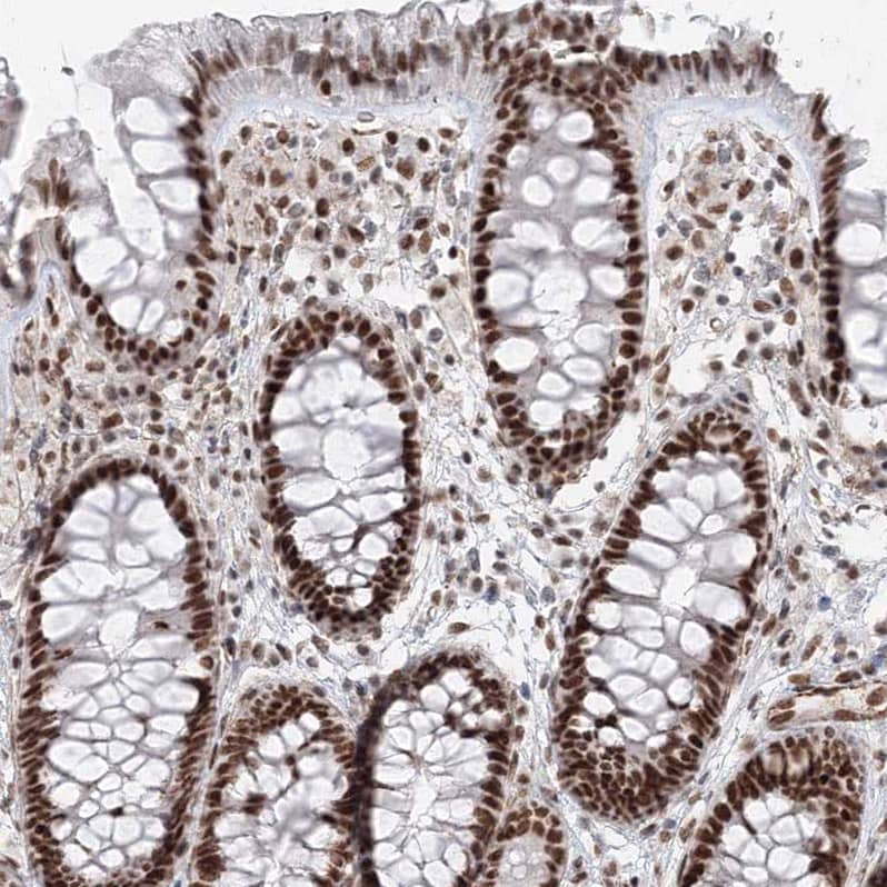 Immunohistochemistry-Paraffin ZNF638 Antibody - BSA Free