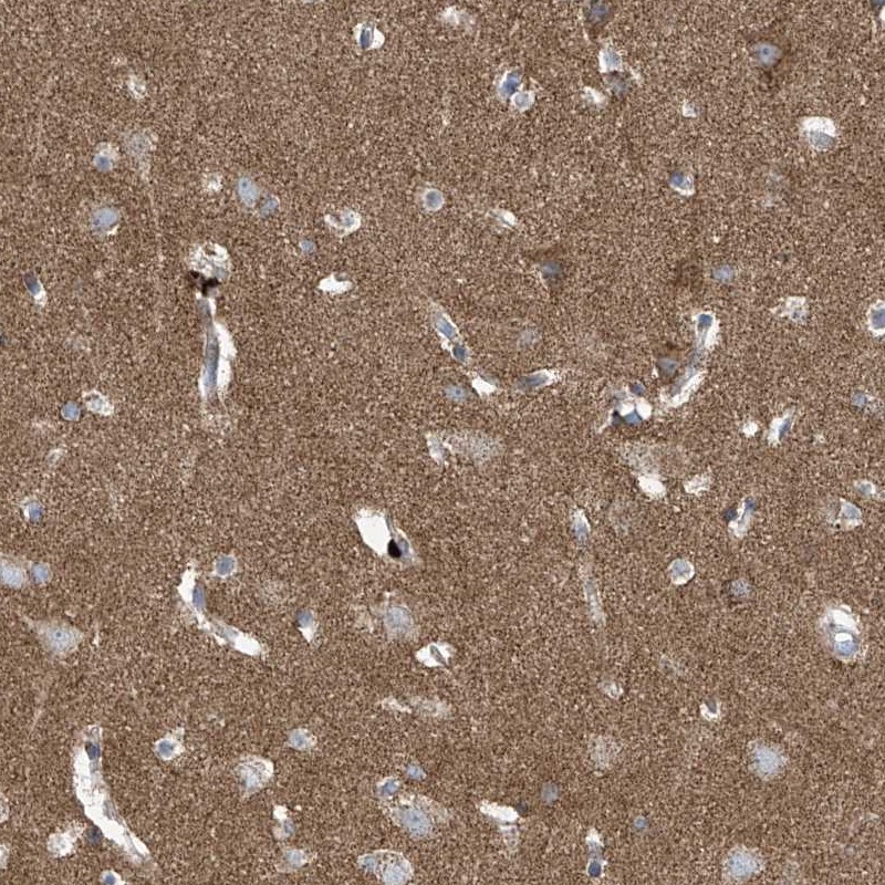 Staining of human cerebral cortex shows moderate positivity in neuropil.