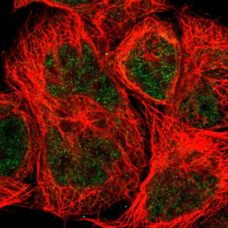 Staining of human cell line A-431 shows localization to nucleoplasm & cytosol.