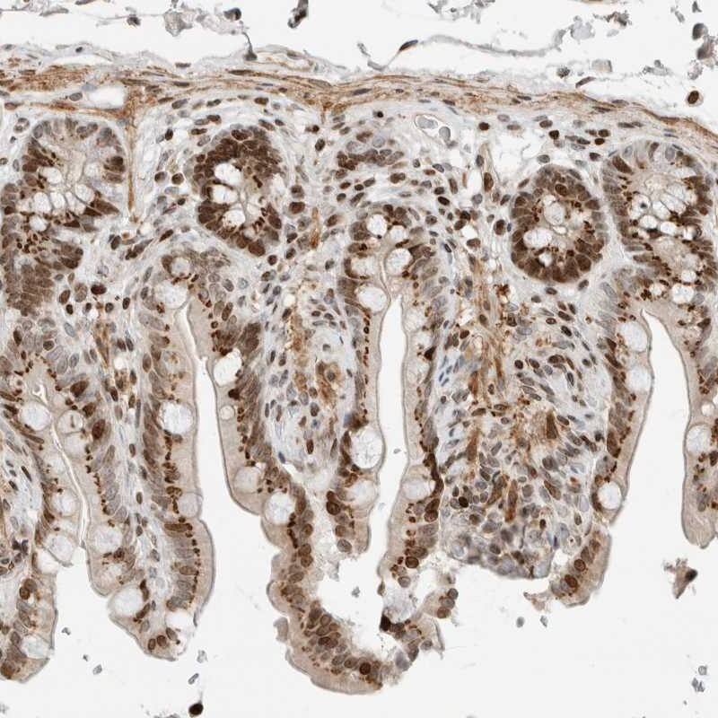 Immunohistochemistry-Paraffin GINS4 Antibody - BSA Free