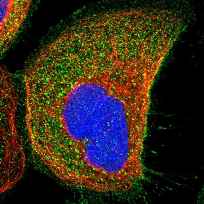 Staining of human cell line A-431 shows localization to plasma membrane & cytosol.