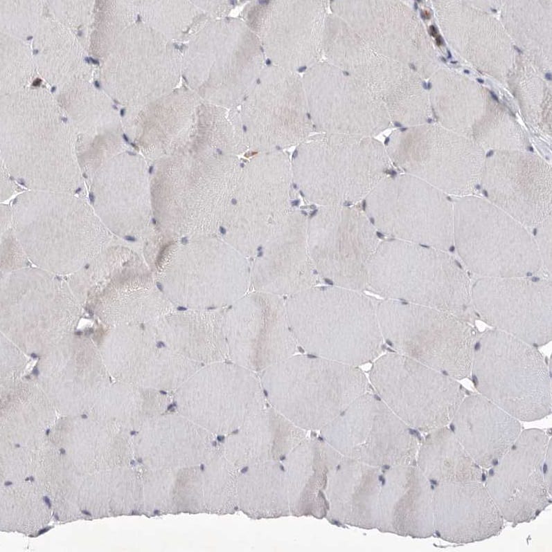Staining of human skeletal muscle shows no positivity in myocytes as expected.