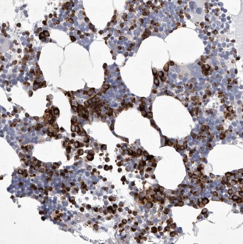 Staining of human bone marrow shows strong cytoplasmic / membranous positivity in hematopoietic cells.