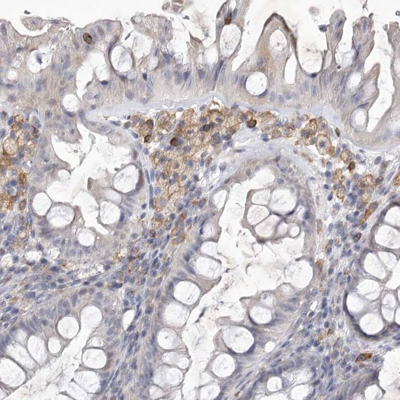 Staining of human colon shows weak to moderate cytoplasmic / membranous positivity in lymphoid cells.