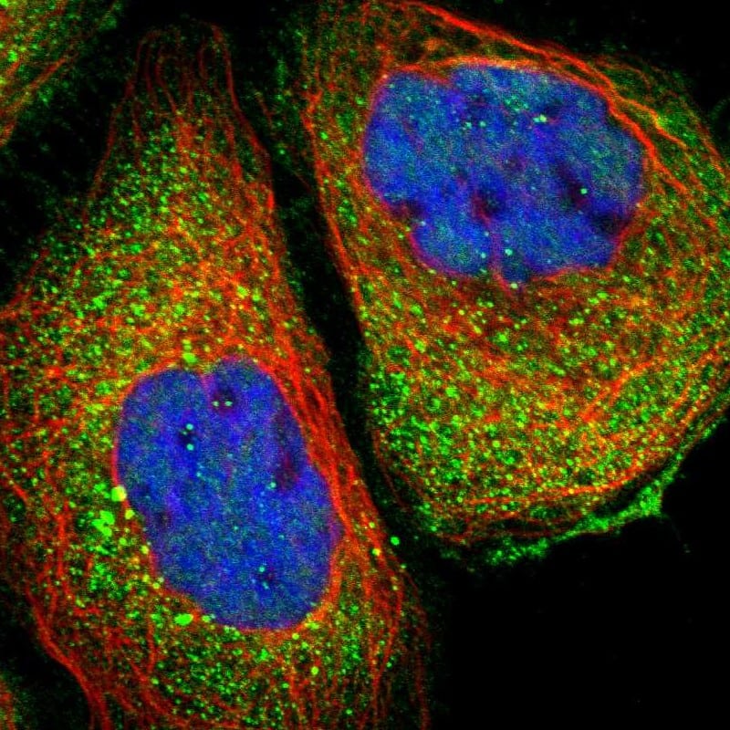 Staining of human cell line A-431 shows localization to cytosol.