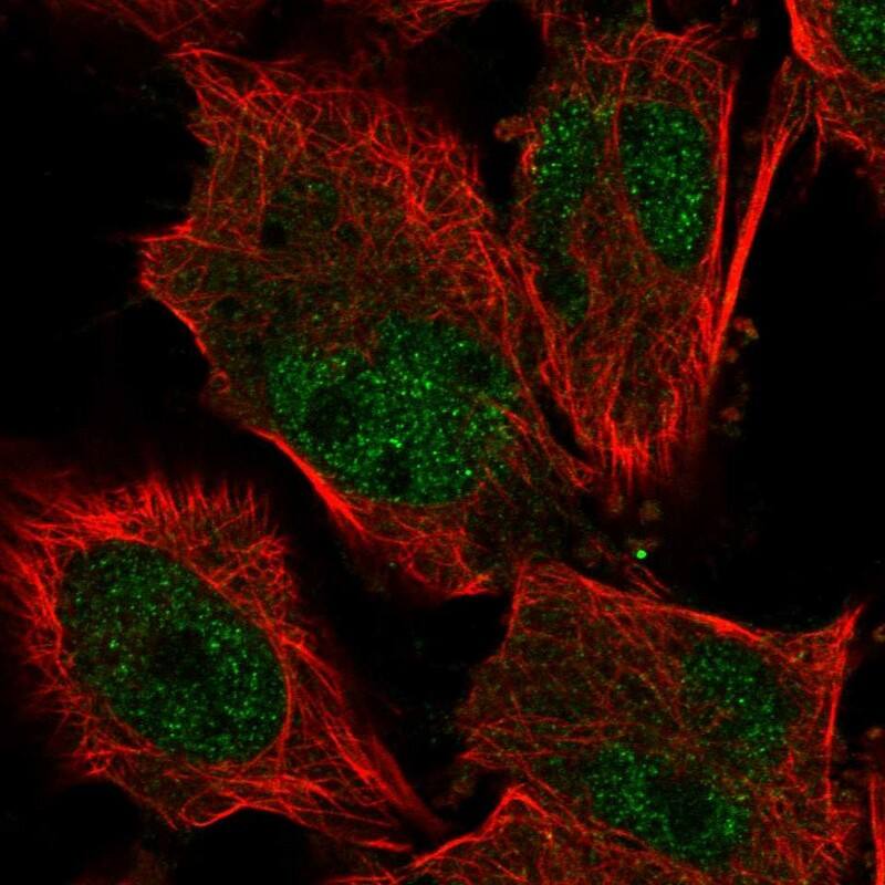 Immunocytochemistry/ Immunofluorescence KIF9 Antibody - BSA Free
