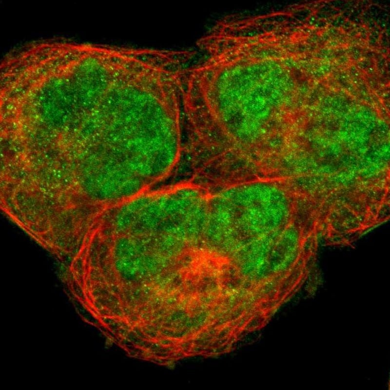Staining of human cell line A-431 shows localization to nucleoplasm & cytosol.