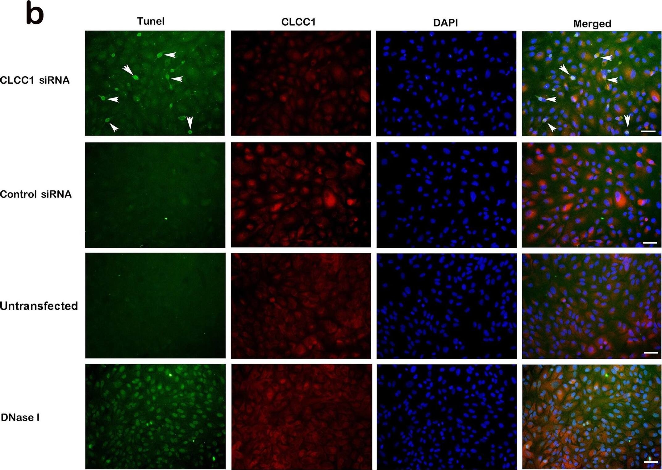 CLCC1 siRNA interference in ARPE19 cells.(a) Western Blot of SiRNA treated ARPE19 cell lysates probed with CLCC1 antibodies. Lane 1, untransfected lysate; lane 2, transfected with RNAi Max transfection reagent only; lanes 3–12, Increasing CLCC1 and control siRNA amounts from 10 pmol (lanes 3,4) to 70 pmol (lanes 11, 12). CLCC1 proteins migrate at the predicted MW of 67 kDa. The blot shows a dose dependent reduction of CLCC1 protein expression in CLCC1 but not control siRNA treated ARPE19 cells to about 20% of normal. (b) TUNEL assay after siRNA transfection. Left: TUNEL-positive apoptotic cells (green), Second: CLCC1 (red), Third: DAPI (blue, nucleus). Although there is some variation in intensity of individual cells, probably based on cell size, shape, and orientation, staining for CLCC1 is lower overall in the CLCC1 siRNA treated cells than the control siRNA, control, or DNase 1 cells, consistent with the Western blot in Fig 5a. About 10% of CLCC1 siRNA transfected cells were apoptotic (arrows) but there is minimal apoptosis in control siRNA or untransfected cells. DNase I treated cells were 100% TUNEL-positive. Overlays of images from the first three columns are shown in the right column labeled Merged. Scale Bar: 20 μm. (c) Down regulation of CLCC1 induced apoptosis in nearly 10% of the cells (*** P<0.0001, t = 14.63) as compared to approximately 1% of cells treated with the control siRNA and less than 1% of untreated cells. Image collected and cropped by CiteAb from the following open publication (//pubmed.ncbi.nlm.nih.gov/30157172), licensed under a CC0-1.0 license. Not internally tested by Novus Biologicals.