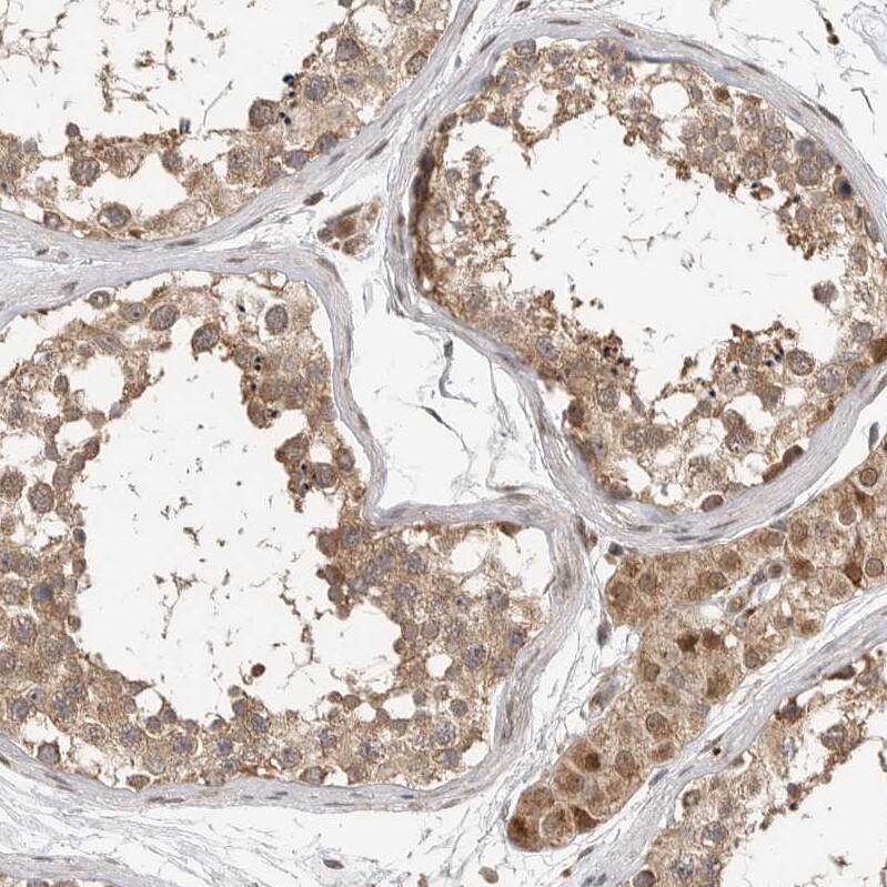 Staining of human testis shows moderate cytoplasmic positivity in cells in seminiferous ducts.