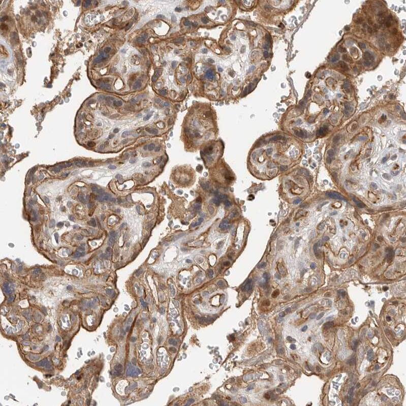 Staining of human placenta shows moderate membranous positivity in trophoblastic cells.