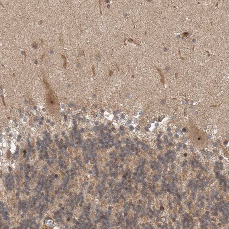 Staining of human cerebellum shows moderate cytoplasmic and strong nucleolar positivity in Purkinje cells.