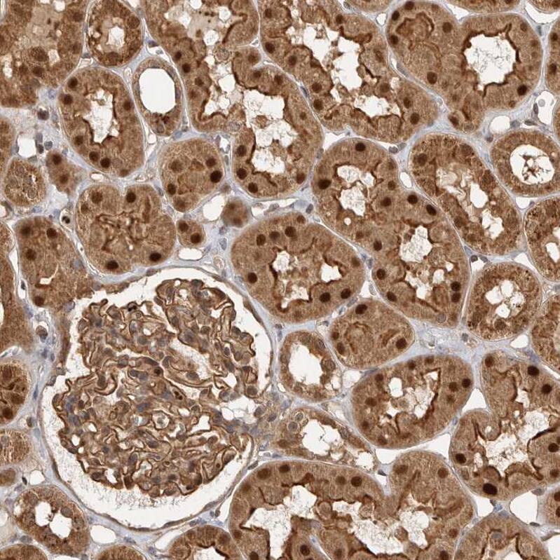 Staining of human kidney shows moderate cytoplasmic, moderate membranous and strong nuclear positivity in cells in tubules.