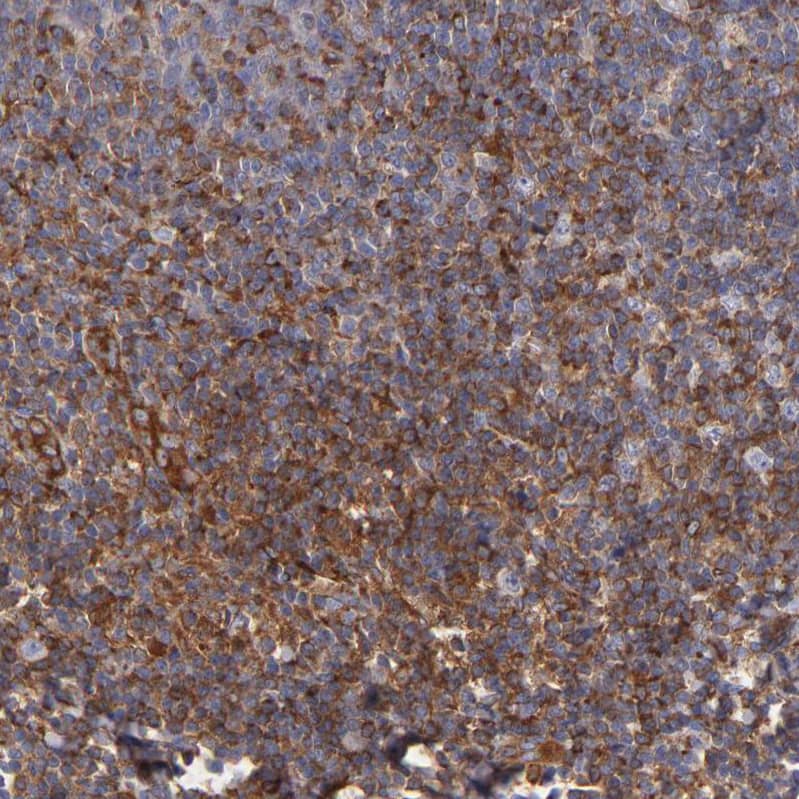 Staining of human tonsil shows moderate cytoplasmic positivity in non-germinal center cells.
