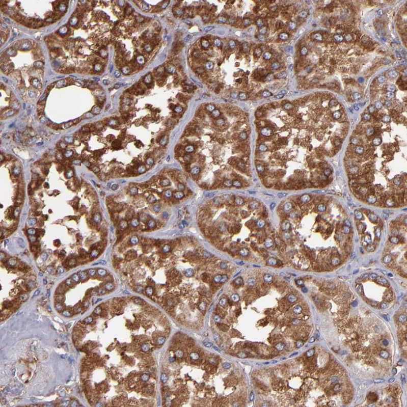 Staining of human kidney shows strong cytoplasmic positivity in cells in tubules.