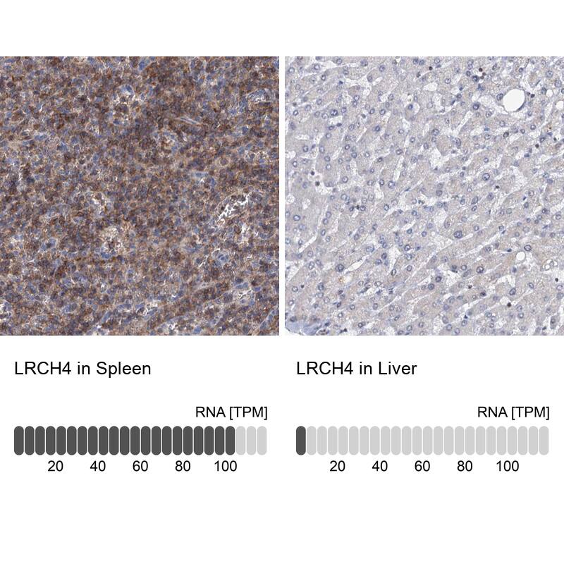 <b>Orthogonal Strategies Validation. </b>Analysis in human spleen and liver tissues.