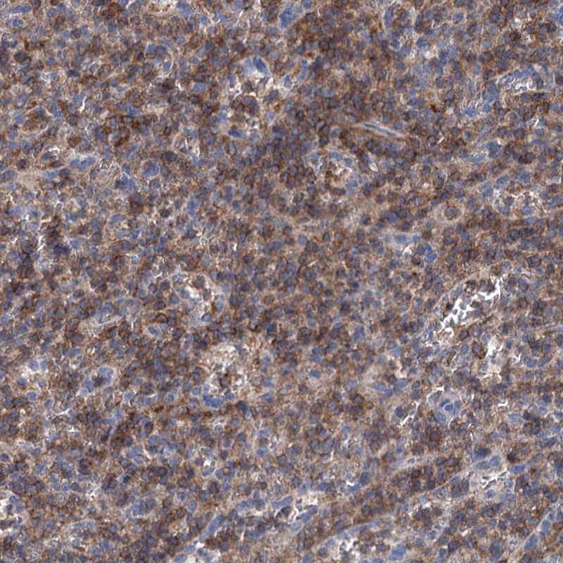 Staining of human spleen shows high expression.