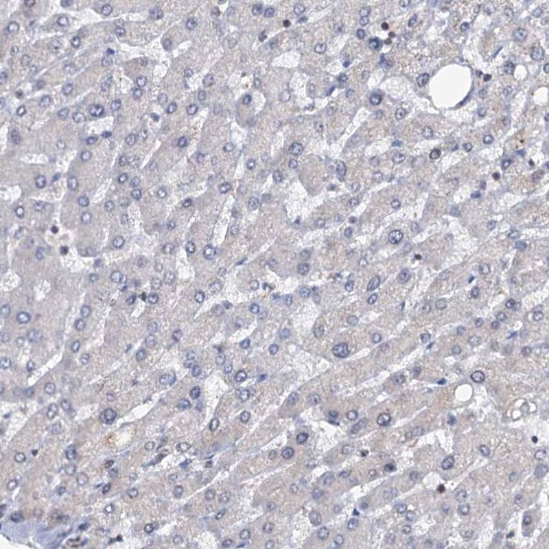 Staining of human liver shows low expression as expected.