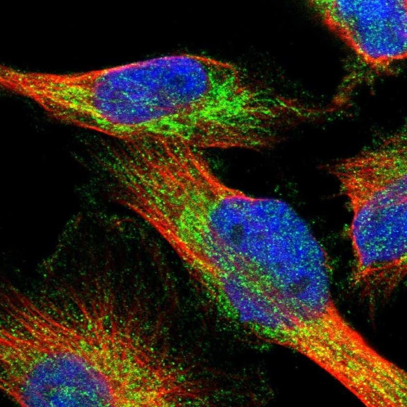 Staining of human cell line U-251 MG shows localization to mitochondria & vesicles.