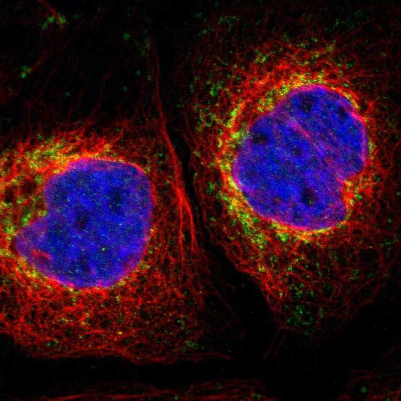 Staining of human cell line A-431 shows localization to mitochondria.