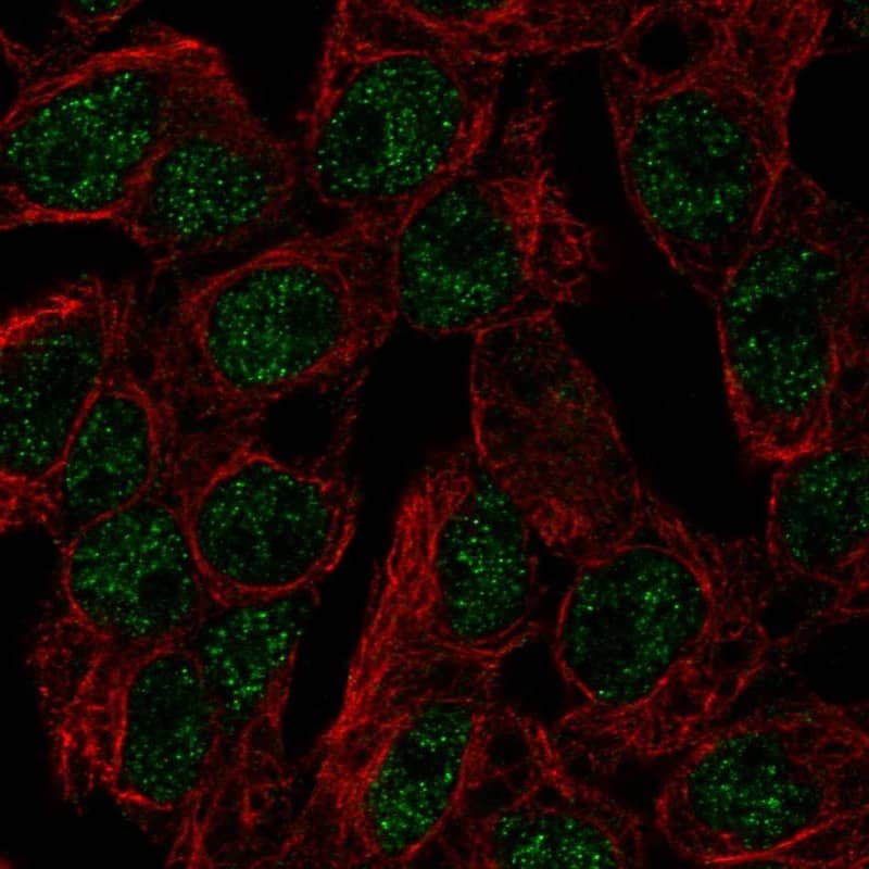 Immunocytochemistry/ Immunofluorescence SLC5A11 Antibody - BSA Free