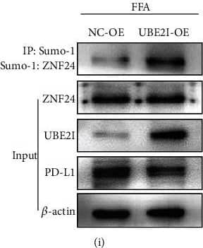 Identification of ZNF24–UBE2I protein interactions. (a & b) Analysis of protein interactions between ZNF24 & UBE2I using the BioGRID database, further confirmed by Co-IP assays. (c–f) UBE2I expression in LO2 cells treated by FFA or pretreated with siRNA against NOX4, MitoTEMPO (10 μM), or NAC (5 mM) followed by FFA treatment measured by western blot. (g & h) After FFA treatment, Sumo-1: ZNF24 & ZNF24 expression levels detected by western blot. (i & j) After UBE2I overexpression, Sumo-1: ZNF24, ZNF24, PD-L1, & UBE2I expression levels were determined by western blot. (k–m) Dual-luciferase reporter assays performed in LO2 cells transfected with WT plasmid containing ZNF24-binding sites in the PD-L1 promoter using Lipofectamine 2000 after ZNF24 overexpression with or without Sumo-1 overexpression. ∗∗P < 0.01. Image collected & cropped by CiteAb from the following publication (//pubmed.ncbi.nlm.nih.gov/35615575), licensed under a CC-BY license. Not internally tested by Novus Biologicals.