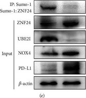 ROS/ZNF24/PD-L1 pathway activation in NAFLD models. (a) Intracellular ROS in hepatocytes in NAFLD significantly increased. (b) JC-1 probes were used to detect mitochondrial membrane potential. (c & d) NOX4 & ZNF24 expressions were determined by immunohistochemistry. (e & f) ROS/ZNF24/PD-L1 pathway activation examined by western blot. Image collected & cropped by CiteAb from the following publication (//pubmed.ncbi.nlm.nih.gov/35615575), licensed under a CC-BY license. Not internally tested by Novus Biologicals.