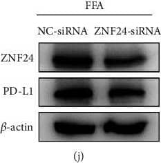 ZNF24 promoted PD-L1 expression through binding to its promoter in FFA-treated LO2 cells. (a) A schematic of the target sites (wild & mutant) of ZNF24 in the promoter of PD-L1. (b–d) Dual-luciferase reporter assays performed in LO2 cells transfected with WT or MT plasmid containing ZNF24-binding sites in the PD-L1 promoter using Lipofectamine 2000 after ZNF24 overexpression. (e–g) ZNF24 expression after FFA treatment determined by qRT-PCR & western blot. (h & i) ZNF24 expression in LO2 cells pretreated with siRNA against NOX4, MitoTEMPO (10 μM), or NAC (5 mM) followed by FFA treatment, measured by western blot. (j & k) ZNF24 & PD-L1 expression in LO2 cells pretreated with siRNA against ZNF24, followed by FFA treatment detected by western blot. ∗∗P < 0.01. Image collected & cropped by CiteAb from the following publication (//pubmed.ncbi.nlm.nih.gov/35615575), licensed under a CC-BY license. Not internally tested by Novus Biologicals.