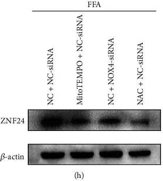 Western Blot: ZNF24 Antibody [NBP1-82866] - ZNF24 promoted PD-L1 expression through binding to its promoter in FFA-treated LO2 cells. (a) A schematic of the target sites (wild & mutant) of ZNF24 in the promoter of PD-L1. (b–d) Dual-luciferase reporter assays performed in LO2 cells transfected with WT or MT plasmid containing ZNF24-binding sites in the PD-L1 promoter using Lipofectamine 2000 after ZNF24 overexpression. (e–g) ZNF24 expression after FFA treatment determined by qRT-PCR & western blot. (h & i) ZNF24 expression in LO2 cells pretreated with siRNA against NOX4, MitoTEMPO (10 μM), or NAC (5 mM) followed by FFA treatment, measured by western blot. (j & k) ZNF24 & PD-L1 expression in LO2 cells pretreated with siRNA against ZNF24, followed by FFA treatment detected by western blot. ∗∗P < 0.01. Image collected & cropped by CiteAb from the following publication (//pubmed.ncbi.nlm.nih.gov/35615575), licensed under a CC-BY license. Not internally tested by Novus Biologicals.