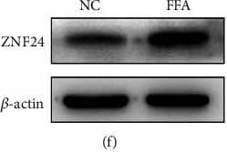 Western Blot: ZNF24 Antibody [NBP1-82866] - ZNF24 promoted PD-L1 expression through binding to its promoter in FFA-treated LO2 cells. (a) A schematic of the target sites (wild & mutant) of ZNF24 in the promoter of PD-L1. (b–d) Dual-luciferase reporter assays performed in LO2 cells transfected with WT or MT plasmid containing ZNF24-binding sites in the PD-L1 promoter using Lipofectamine 2000 after ZNF24 overexpression. (e–g) ZNF24 expression after FFA treatment determined by qRT-PCR & western blot. (h & i) ZNF24 expression in LO2 cells pretreated with siRNA against NOX4, MitoTEMPO (10 μM), or NAC (5 mM) followed by FFA treatment, measured by western blot. (j & k) ZNF24 & PD-L1 expression in LO2 cells pretreated with siRNA against ZNF24, followed by FFA treatment detected by western blot. ∗∗P < 0.01. Image collected & cropped by CiteAb from the following publication (//pubmed.ncbi.nlm.nih.gov/35615575), licensed under a CC-BY license. Not internally tested by Novus Biologicals.