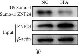 Western Blot: ZNF24 Antibody [NBP1-82866] - Identification of ZNF24–UBE2I protein interactions. (a & b) Analysis of protein interactions between ZNF24 & UBE2I using the BioGRID database, further confirmed by Co-IP assays. (c–f) UBE2I expression in LO2 cells treated by FFA or pretreated with siRNA against NOX4, MitoTEMPO (10 μM), or NAC (5 mM) followed by FFA treatment measured by western blot. (g & h) After FFA treatment, Sumo-1: ZNF24 & ZNF24 expression levels detected by western blot. (i & j) After UBE2I overexpression, Sumo-1: ZNF24, ZNF24, PD-L1, & UBE2I expression levels were determined by western blot. (k–m) Dual-luciferase reporter assays performed in LO2 cells transfected with WT plasmid containing ZNF24-binding sites in the PD-L1 promoter using Lipofectamine 2000 after ZNF24 overexpression with or without Sumo-1 overexpression. ∗∗P < 0.01. Image collected & cropped by CiteAb from the following publication (//pubmed.ncbi.nlm.nih.gov/35615575), licensed under a CC-BY license. Not internally tested by Novus Biologicals.