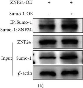 Western Blot: ZNF24 Antibody [NBP1-82866] - Identification of ZNF24–UBE2I protein interactions. (a & b) Analysis of protein interactions between ZNF24 & UBE2I using the BioGRID database, further confirmed by Co-IP assays. (c–f) UBE2I expression in LO2 cells treated by FFA or pretreated with siRNA against NOX4, MitoTEMPO (10 μM), or NAC (5 mM) followed by FFA treatment measured by western blot. (g & h) After FFA treatment, Sumo-1: ZNF24 & ZNF24 expression levels detected by western blot. (i & j) After UBE2I overexpression, Sumo-1: ZNF24, ZNF24, PD-L1, & UBE2I expression levels were determined by western blot. (k–m) Dual-luciferase reporter assays performed in LO2 cells transfected with WT plasmid containing ZNF24-binding sites in the PD-L1 promoter using Lipofectamine 2000 after ZNF24 overexpression with or without Sumo-1 overexpression. ∗∗P < 0.01. Image collected & cropped by CiteAb from the following publication (//pubmed.ncbi.nlm.nih.gov/35615575), licensed under a CC-BY license. Not internally tested by Novus Biologicals.