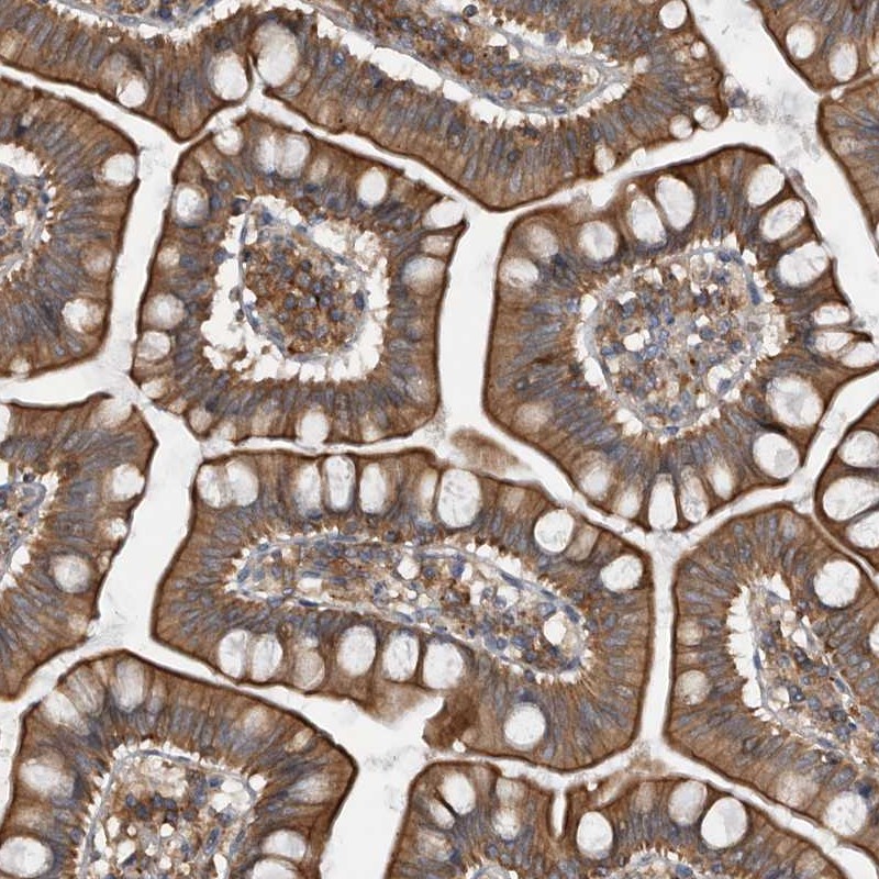 Immunohistochemistry-Paraffin ZWINT Antibody - BSA Free