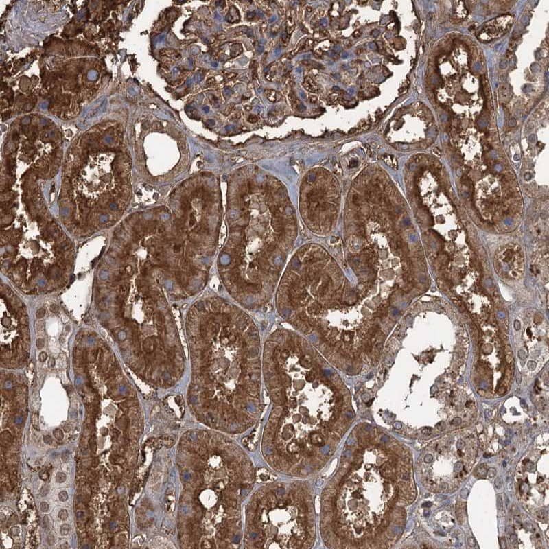 <b>Genetic Strategies Validation. </b>Staining of human kidney shows strong cytoplasmic and membranous positivity in cells in tubules.
