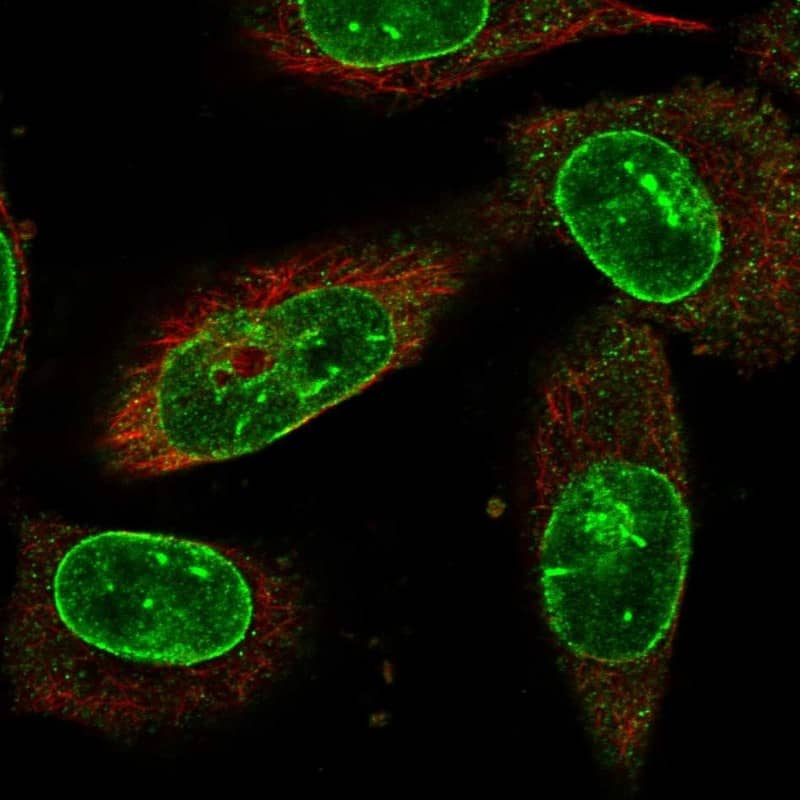 Staining of human cell line U-251 MG shows localization to nuclear membrane.