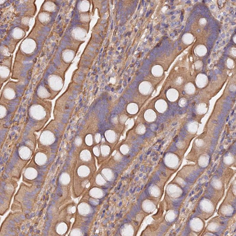 Immunohistochemistry-Paraffin VPS18 Antibody - BSA Free