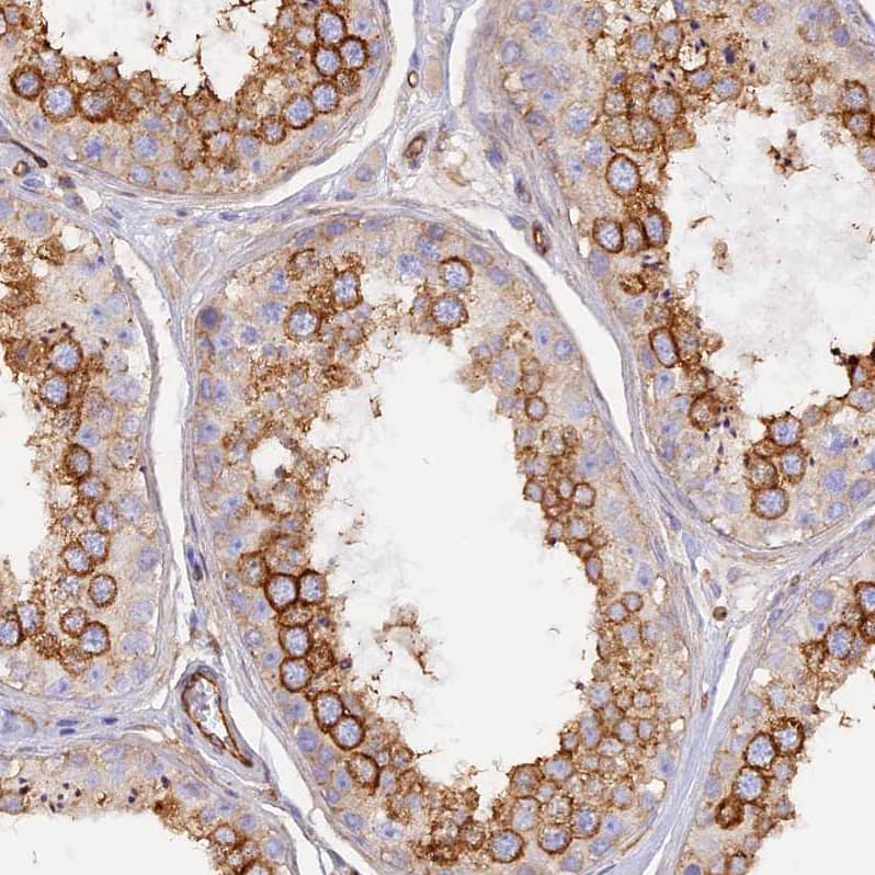 Immunohistochemistry-Paraffin VPS18 Antibody - BSA Free