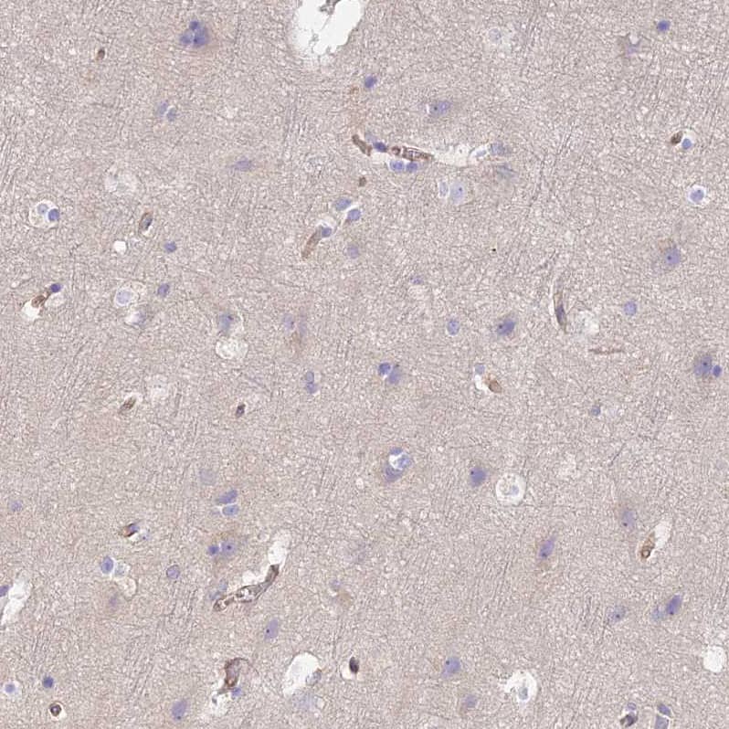 Staining of human cerebral cortex shows no cytoplasmic positivity in neuronal cells as expected.