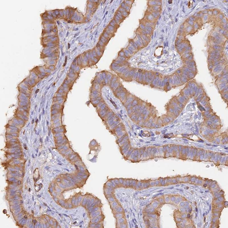 Staining of human fallopian tube shows moderate cytoplasmic positivity in glandular cells.